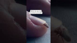 Bed bugs infesting Paris