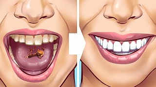 Easy teeth hacks this one is all about our precious teeth! unusual
ways to get a smile of your dreams, necessary tips on the care, for
figuring ou...