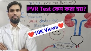 Pvr Test কন কর হয?Post Void Resdual