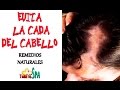 EVITA LA CAÍDA DEL CABELLO DE FORMA NATURAL/ PREVENT HAIR LOSS NATURAL TIPS