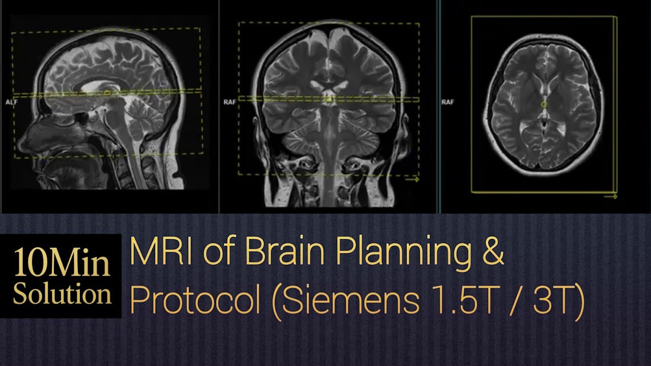 MRI Brain Planning Step-by-Step Guide | Brain MRI Positioning & Protocols Explained