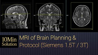 MRI Brain Planning Step-by-Step Guide | Brain MRI Positioning & Protocols Explained
