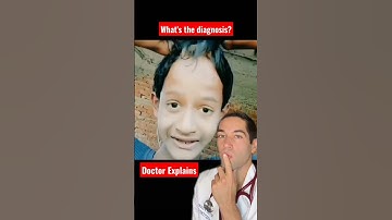 Extremely stretchy skin - Whats the diagnosis? - Doctor Reacts #doctor #shorts