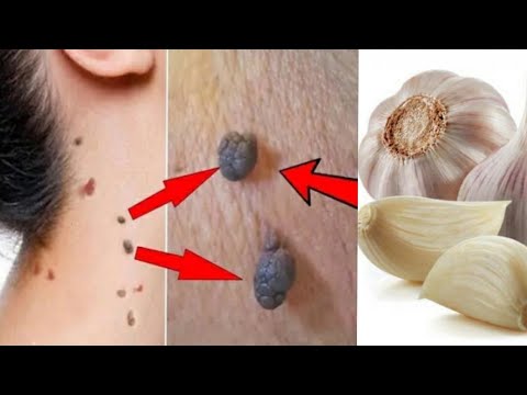 Video: 6 formas de quitar una etiqueta de piel de su cuello