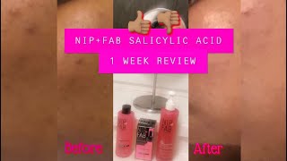 NIP + FAB 1 WEEK SALICYLIC ACID RANGE REVIEW | BEFORE &amp; AFTER