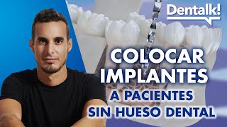 Cómo COLOCAR IMPLANTES a pacientes sin hueso o POCO HUESO DENTAL | Dentalk! ©
