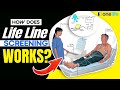 Life Line Screening Review For Early Health Detection: How It Works, Appointment, Price & Location