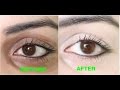 How to remove dark circles naturally in 3 days 100 results