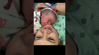 Mother Giving birth❤ A#shorts #love #viral #trending #cutebabay