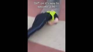 DVT on it's way to become a Pulmonary Embolism