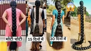 मैंने 30 दिन सिर्फ ये लगाया? Onion and Curry leaves for Hair Growth! Control Hair Loss 