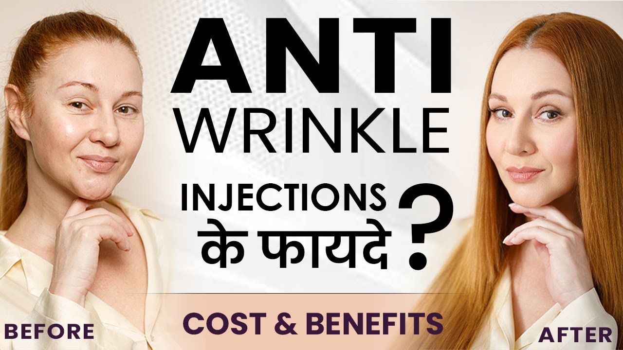 What is Anti-Wrinkle Injection ? | झुर्रियों को दूर करने का अच्छा इलाज | Skin Care | Dermatologist