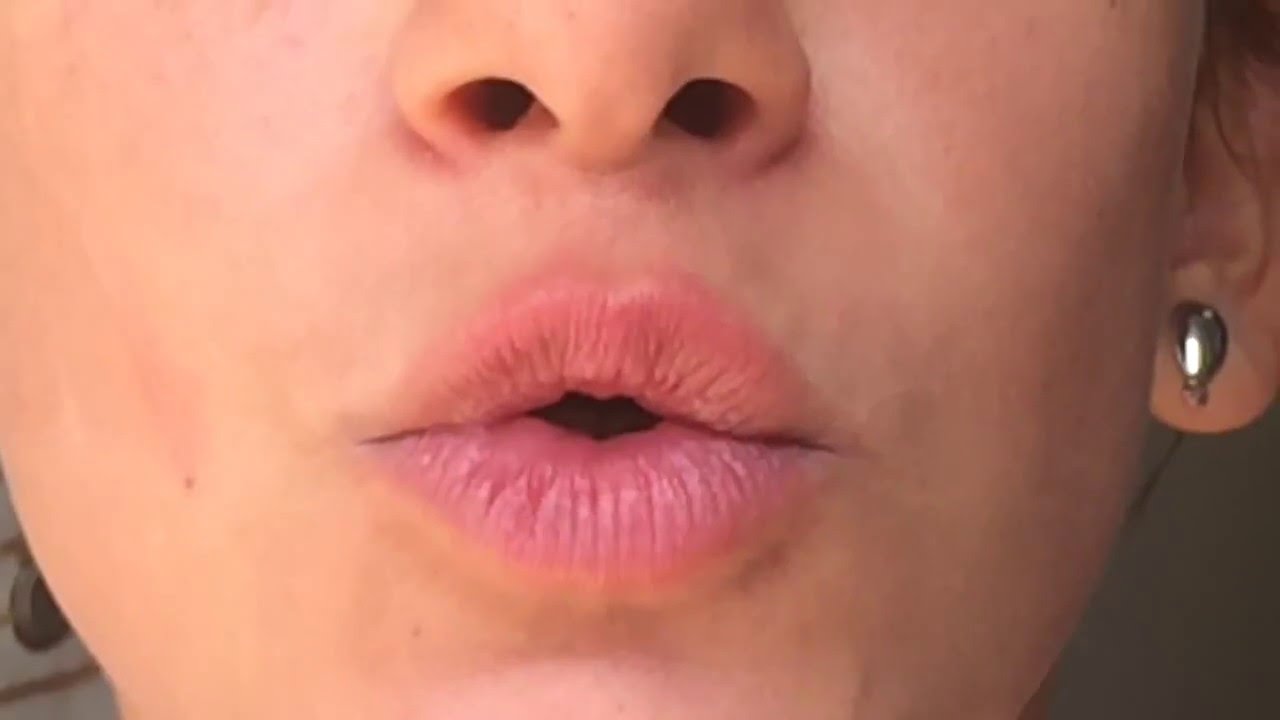 LA «DINÁMICA» DEL ORBICULAR DE LOS LABIOS,