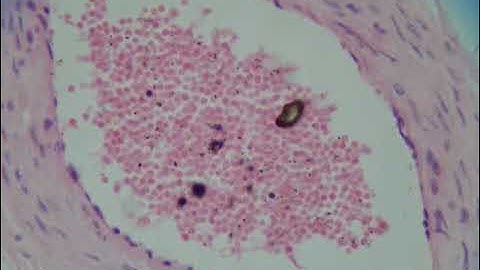 CORPORA CAVERNOSA, PENIS, ERECTILE DYSFUNCTION