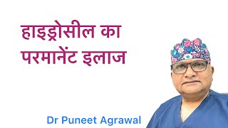 Can Hydrocele Be Cured By Medicine Or Naturally Or Cured Itself?