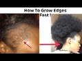 Grow Edges Back & Fix Bald Spots In TWO WEEKS !