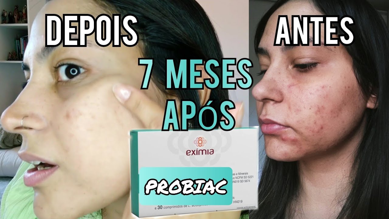 7 MESES APÓS TOMAR PROBIAC | CRIS MARIA - YouTube