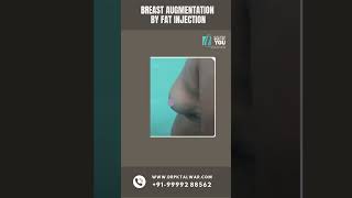 Celebrity Check Out This Amazing Transformation | Breast Augmentation Surgery in Delhi | Dr. PK Talwar Net Worth