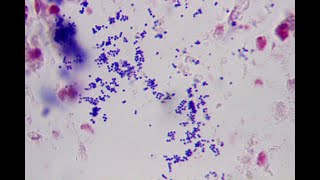 Hybrid Micro Lab 4: Bacterial Structure, Simple Stains, Negative Stains, Gram and Acid-Fast Stains