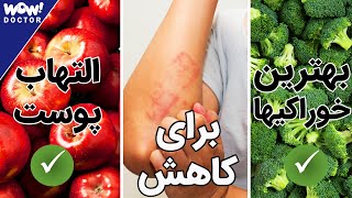 بهترین خوراکی ها برای کاهش التهاب پوست پیست ؟ اگزمای پوستی و رژیم غذایی مناسب برای درمان آن