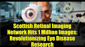 Scottish Retinal Imaging Network Hits 1 Million Images: Revolutionizing Eye Disease Research