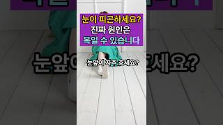 눈이 피곤하세요? 진짜 원인은 ‘스트레스’일 수 있습니다