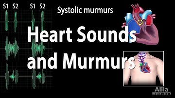 Heart Sounds and Heart Murmurs, Animation.