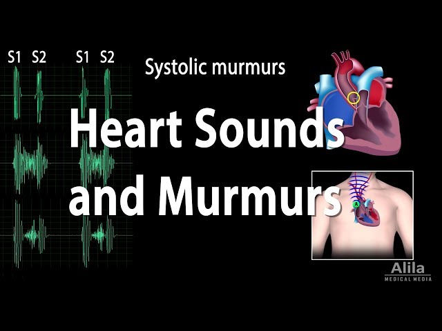 Heart Sounds and Heart Murmurs, Animation. class=