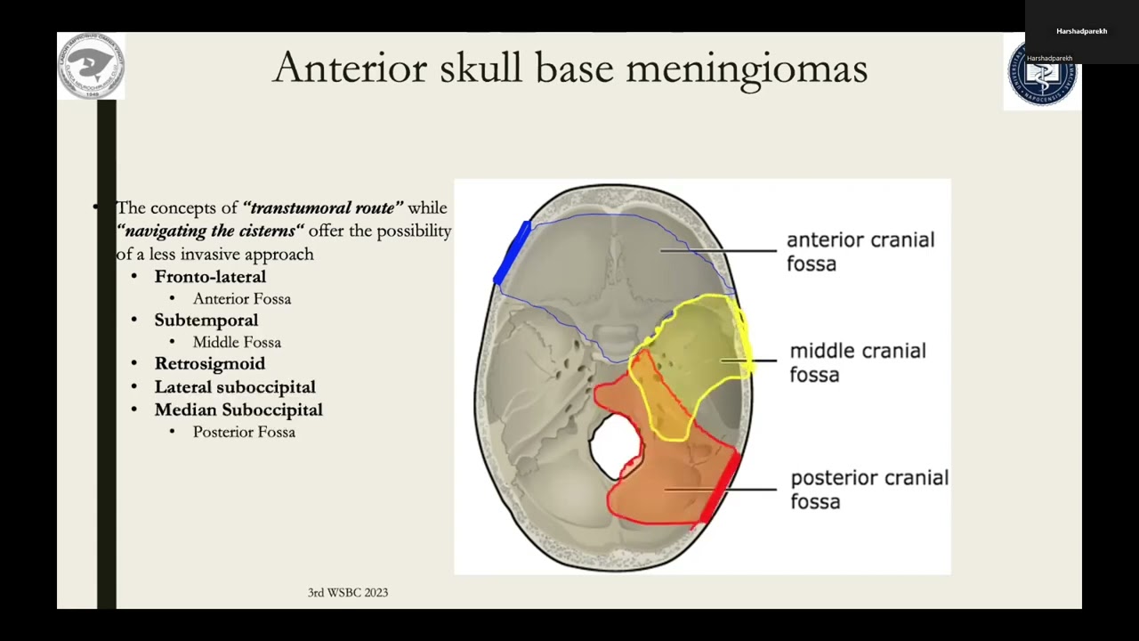 Skull Base Meningiomas – Professor Stefan Florian - YouTube