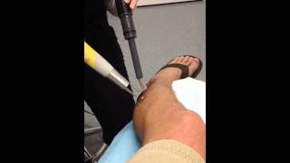 Dr TATTOFF Tattoo Removal