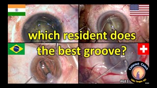 Which resident does the best groove in Cataract Surgery?