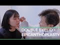 Double eyelid and Epicanthoplasty surgery experience | Korea
