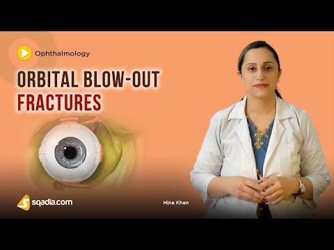 Orbital Blow-Out Fractures | Ophthalmology Lecture | Medical Education | V-Learning