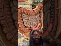 illustration of constipation animation Gut Ai. #anatomy #constipation #humanbody