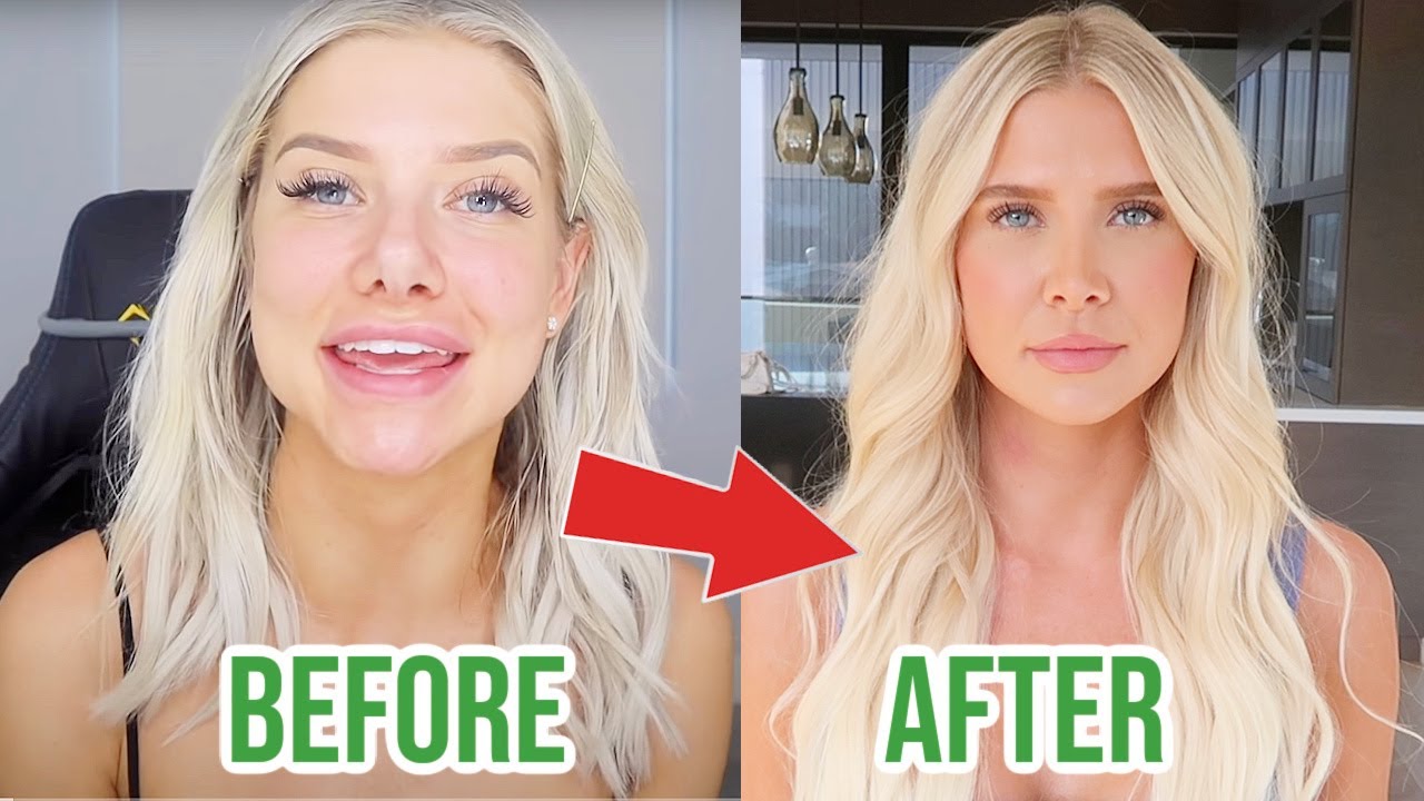 My Plastic Surgery Transformation Story