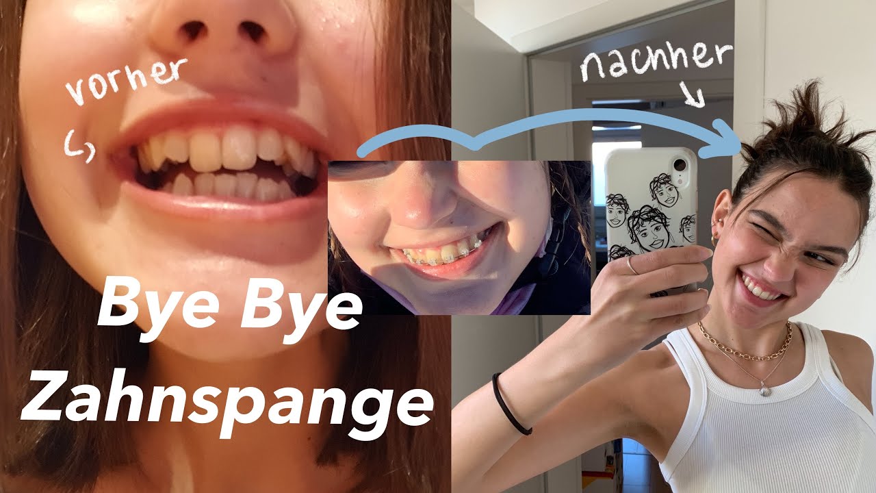 ich bekomme meine Zahnspange raus !!!!!!