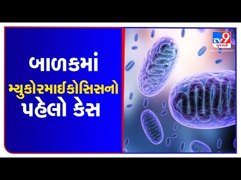 First Case of Mucormycosis among children, operation performed on 13 year old in Ahmedabad | TV9News