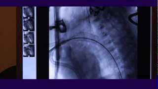 The Children's Hospital at Montefiore | Pediatric Heart Center