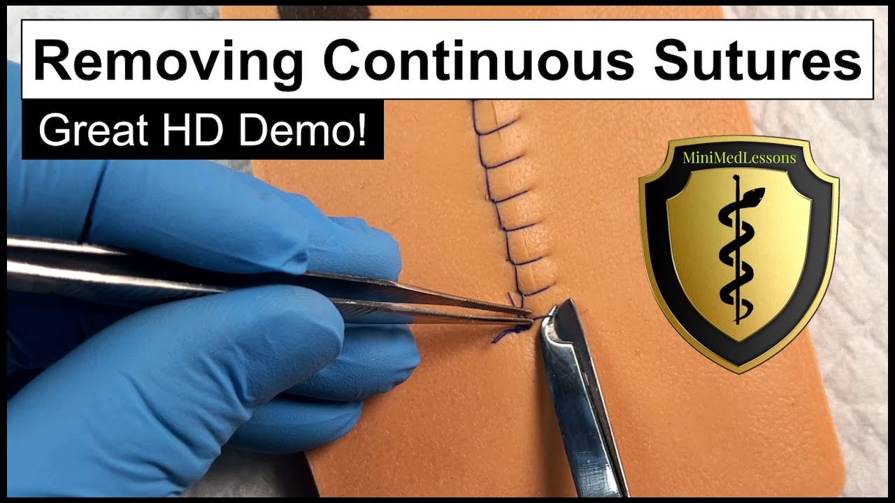 SUTURE Tutorial: How to Remove Continuous Sutures - Best Practices!