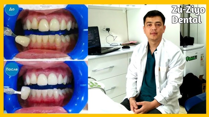 Vaginadan olib tashlangan narsalar Voyaga etganlar uchun porno onlayn