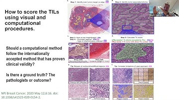 Webinar: Can AI Grand-Challenges inform Regulatory Science in Anatomic Pathology