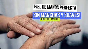 ¿El zumo de limón y el vinagre eliminan las manchas?