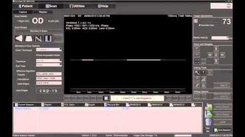 Performing Contact Biometry with the Ellex Eye Cubed
