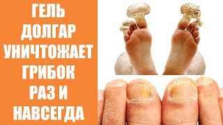 Грибок между пальцами ноги форум