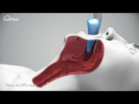 Air-Q3®Intubating Laryngeal Airways