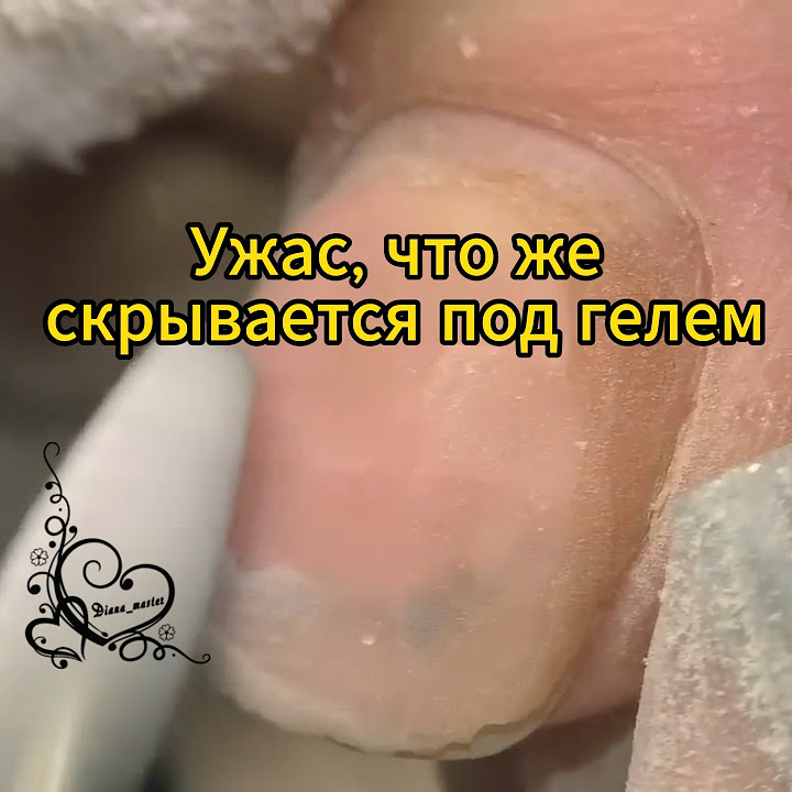 Ужас, что же скрывается под гелем #маникюр #ногти #маникюромск - YouTube