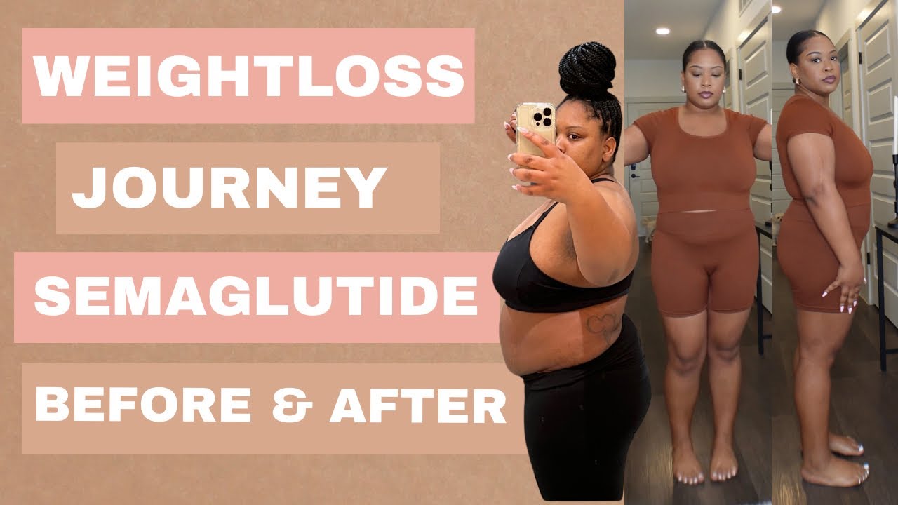 does everyone lose weight on semaglutide How I Lost 50 POUNDS | Semaglutide Weight Loss Before & After  Transformation