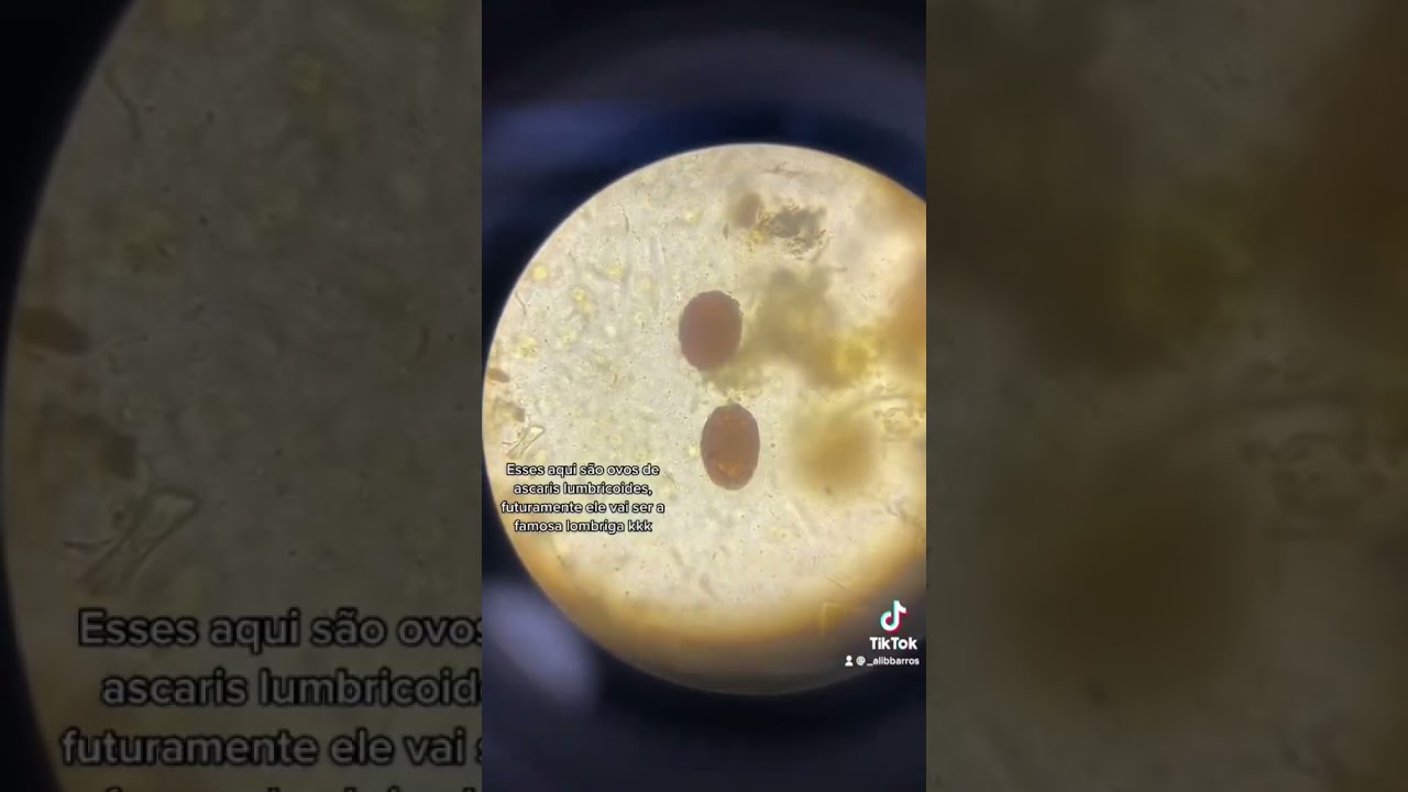 Alguns vermezinhos que podemos encontrar no 💩 