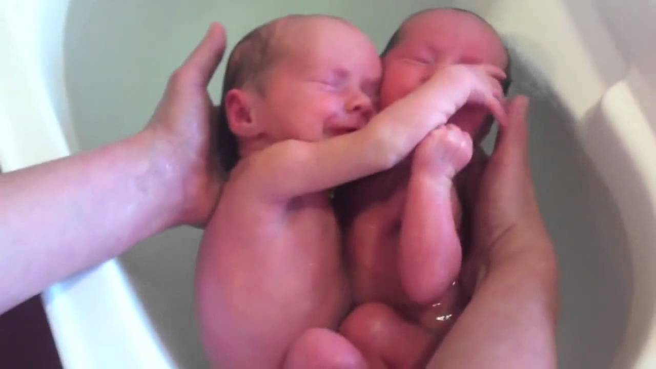 VIDEO CAPTURES UNBREAKABLE BOND BETWEEN TWINS