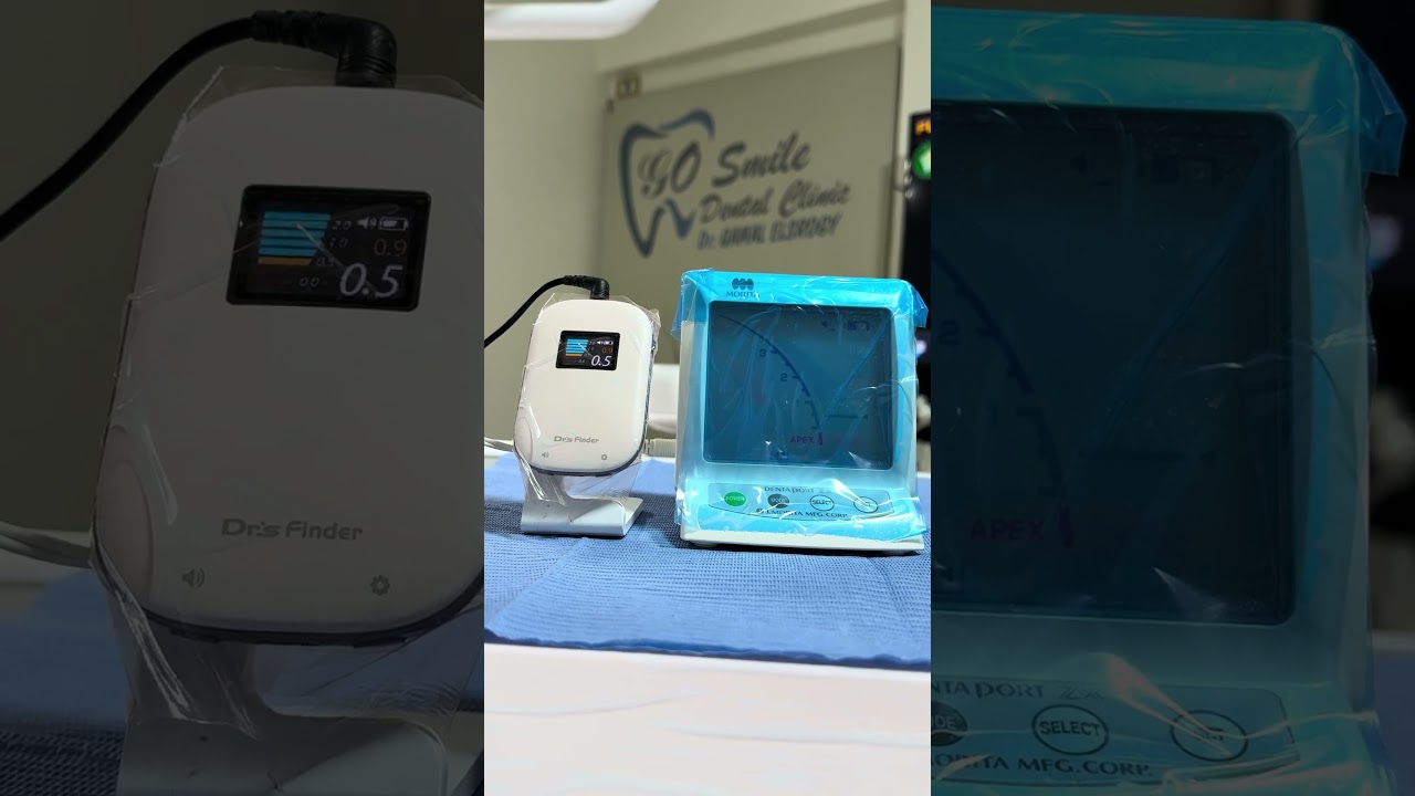 2 Years with Dr. Finder Apex Locator | Accuracy vs Morita Review